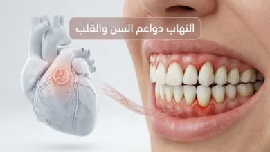 صورة طبية ثلاثية الأبعاد تُظهر التهاب دواعم السن مع إبراز العلاقة المحتملة بين بكتيريا اللثة والصمام الأبهري في القلب.