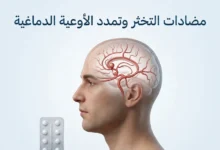 تصيير طبي ثلاثي الأبعاد واقعي لدماغ يُظهر تمدداً وعائياً صغيراً مع إشارة إلى مضادات التخثر في تصميم طبي نظيف.