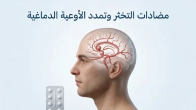تصيير طبي ثلاثي الأبعاد واقعي لدماغ يُظهر تمدداً وعائياً صغيراً مع إشارة إلى مضادات التخثر في تصميم طبي نظيف.