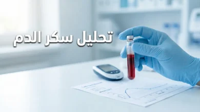 صورة غلاف لمقال تحليل سكر الدم تُظهر أنبوب دم في يد مختبرية مع جهاز قياس سكر وتقرير مخبري في خلفية مختبر حديث نظيف.