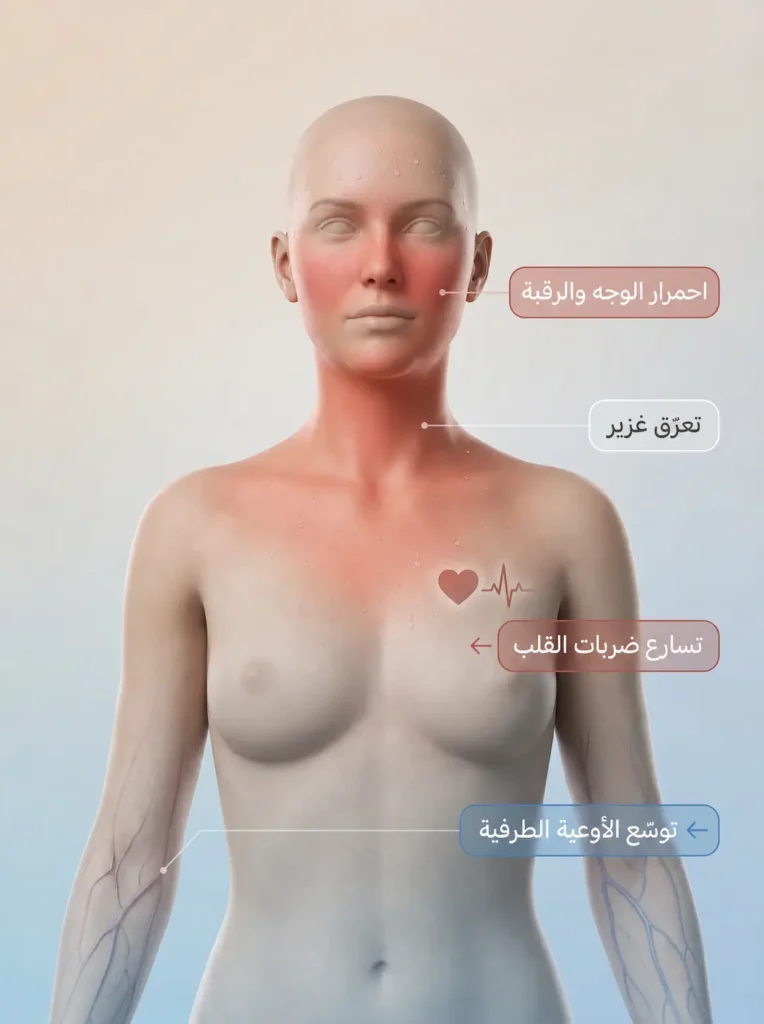 رسم طبي ثلاثي الأبعاد للجزء العلوي من جسم المرأة يوضّح أعراض الهبة الساخنة المتزامنة من احمرار وتعرّق وتسارع القلب وتوسّع الأوعية الطرفية