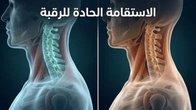 رسم طبي ثلاثي الأبعاد يُظهر الفرق بين العمود الفقري العنقي الطبيعي ذي الانحناء القوسي والعمود الفقري العنقي المستقيم (الاستقامة الحادة للرقبة)