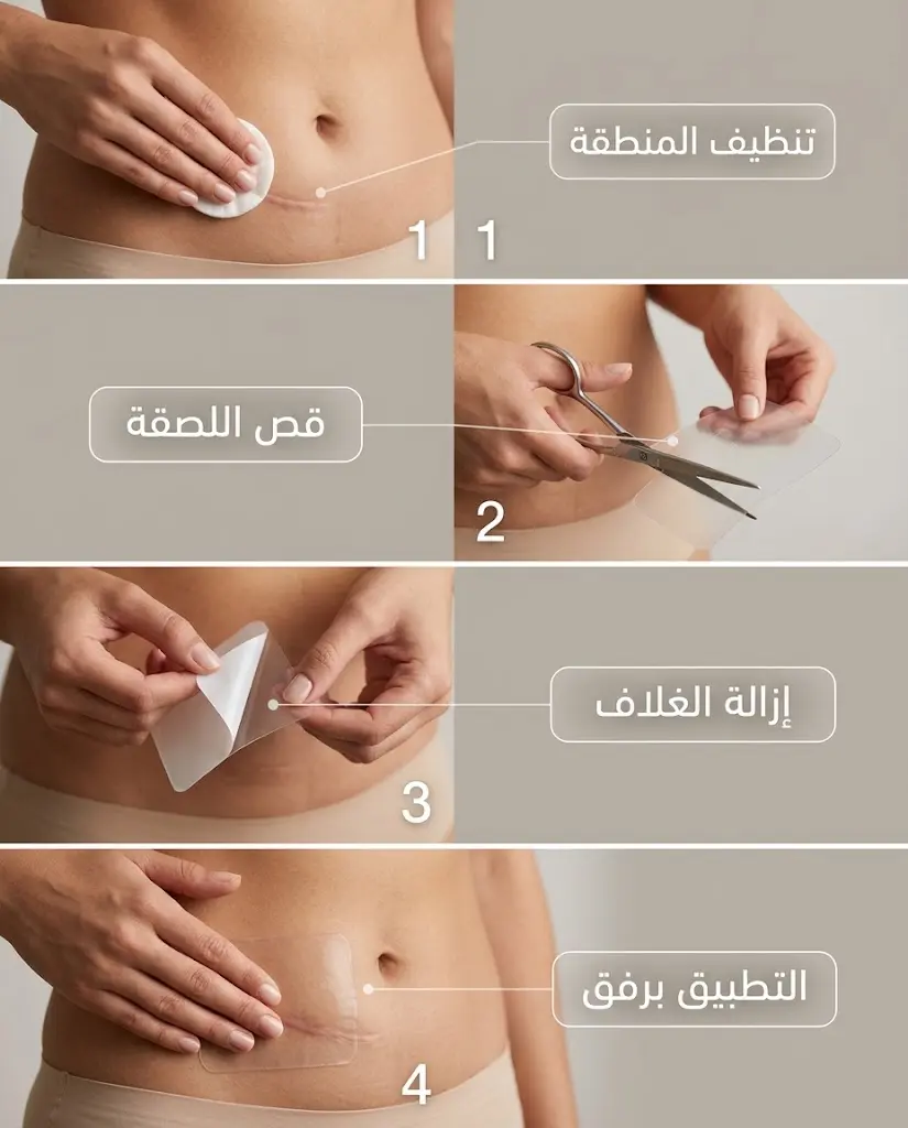 خطوات تطبيق لصقة السيليكون الطبية على الندبة الجراحية