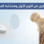 صورة طبية توضيحية تُظهر مقطعًا عرضيًّا لعظم الفخذ مع تدرج من العظم الكثيف السليم إلى العظم الهش المسامي، بجانب رمز لجهاز مراقبة الغلوكوز وظل كلية، مع عنوان السكري من النوع الأول وهشاشة العظام