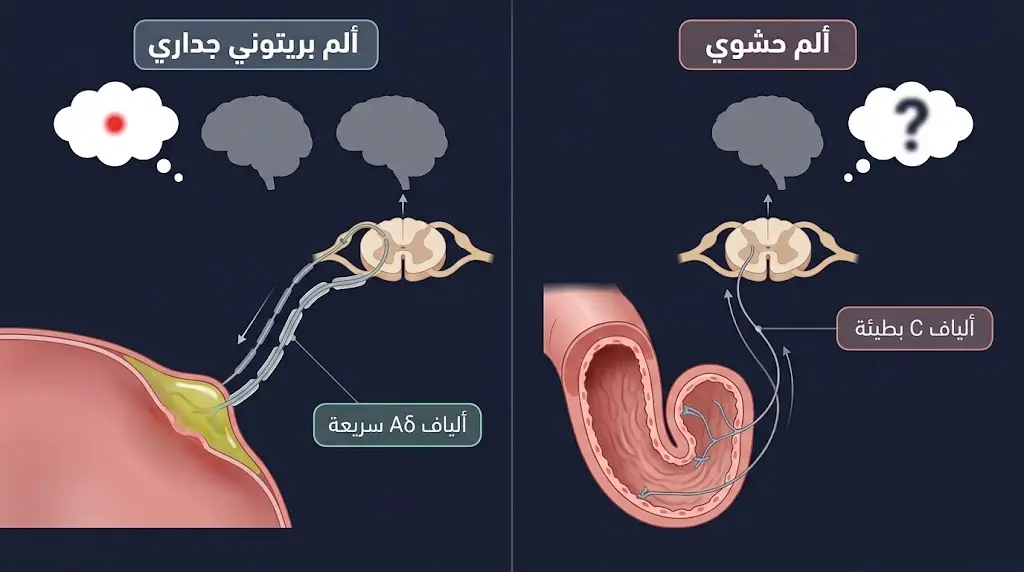 رسم طبي يُقارن بين مسار الألم الحشوي عبر ألياف C البطيئة ومسار الألم البريتوني الجداري عبر ألياف Aδ السريعة
