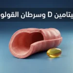 صورة غلاف توضيحية تجمع بين مقطع ثلاثي الأبعاد واقعي للقولون وكبسولة فيتامين D3 ذهبية مع عنوان فيتامين D وسرطان القولون