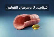 صورة غلاف توضيحية تجمع بين مقطع ثلاثي الأبعاد واقعي للقولون وكبسولة فيتامين D3 ذهبية مع عنوان فيتامين D وسرطان القولون