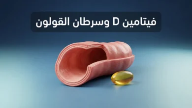 صورة غلاف توضيحية تجمع بين مقطع ثلاثي الأبعاد واقعي للقولون وكبسولة فيتامين D3 ذهبية مع عنوان فيتامين D وسرطان القولون