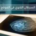 صورة غلاف طبية تُظهر فيلم ماموغرام مضاء بتكلسات دقيقة بيضاء في بيئة سريرية هادئة