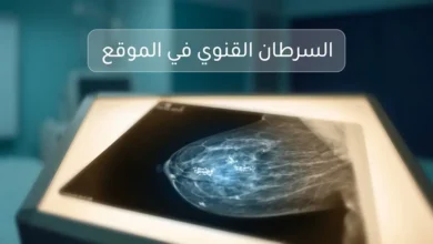 صورة غلاف طبية تُظهر فيلم ماموغرام مضاء بتكلسات دقيقة بيضاء في بيئة سريرية هادئة
