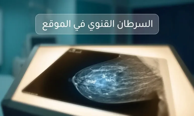 صورة غلاف طبية تُظهر فيلم ماموغرام مضاء بتكلسات دقيقة بيضاء في بيئة سريرية هادئة