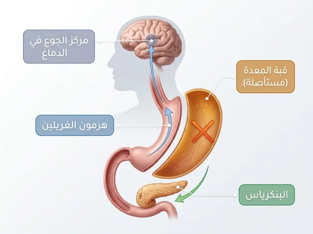 مخطط ثلاثي الأبعاد يوضح انخفاض هرمون الغريلين بعد استئصال قبة المعدة وتأثيره على الدماغ والبنكرياس