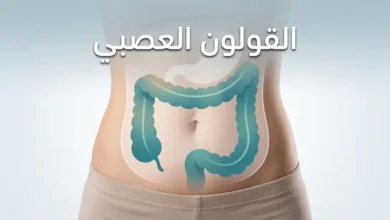 صورة غلاف مقال القولون العصبي تُظهر تمثيلاً تشريحياً هادئاً للقولون الغليظ مع نص "القولون العصبي" في الثلث العلوي.