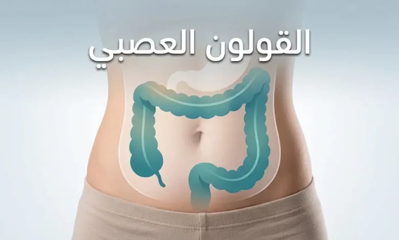 صورة غلاف مقال القولون العصبي تُظهر تمثيلاً تشريحياً هادئاً للقولون الغليظ مع نص "القولون العصبي" في الثلث العلوي.
