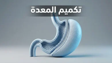 صورة غلاف علمية توضح مفهوم عملية تكميم المعدة بشكل تشريحي واقعي