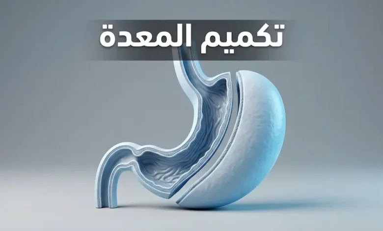 صورة غلاف علمية توضح مفهوم عملية تكميم المعدة بشكل تشريحي واقعي