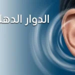 صورة غلاف مقال الدوار الدهليزي تُظهر أذناً بشرية مع تأثير بصري دوراني يرمز إلى فقدان التوازن