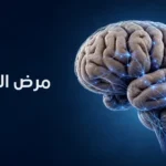 رسم طبي ثلاثي الأبعاد لدماغ بشري لغلاف مقالة عن مرض الزهايمر