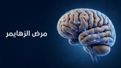 رسم طبي ثلاثي الأبعاد لدماغ بشري لغلاف مقالة عن مرض الزهايمر
