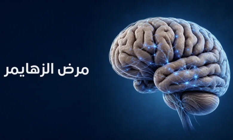 رسم طبي ثلاثي الأبعاد لدماغ بشري لغلاف مقالة عن مرض الزهايمر