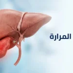 رسم ثلاثي الأبعاد يوضح الكبد والمرارة الملتهبة مع حصاة سادة للقناة المرارية