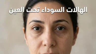 امرأة تظهر عليها هالات سوداء خفيفة تحت العينين بمظهر طبيعي وواقعي