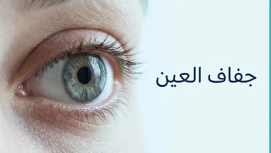 صورة طبية توضيحية لعين بشرية مع إبراز سطح القرنية والانعكاس الدمعي، وعنوان جفاف العين.