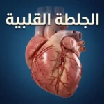 قلب بشري ثلاثي الأبعاد يوضح انسداد شريان تاجي بخثرة دموية، تمثيلاً للجلطة القلبية