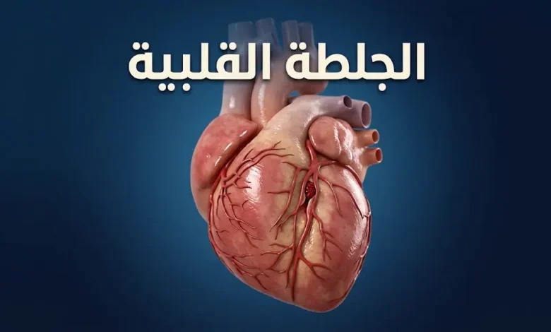 قلب بشري ثلاثي الأبعاد يوضح انسداد شريان تاجي بخثرة دموية، تمثيلاً للجلطة القلبية