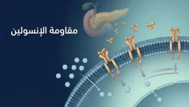 رسم علمي يوضح مستقبلات الإنسولين على غشاء الخلية واستجابتها الضعيفة لجزيئات الإنسولين مع تراكم الغلوكوز خارج الخلية.