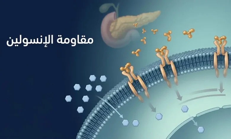 رسم علمي يوضح مستقبلات الإنسولين على غشاء الخلية واستجابتها الضعيفة لجزيئات الإنسولين مع تراكم الغلوكوز خارج الخلية.