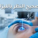 عملية تصحيح النظر بالليزك باستخدام ليزر الإكزايمر في غرفة عمليات معقمة