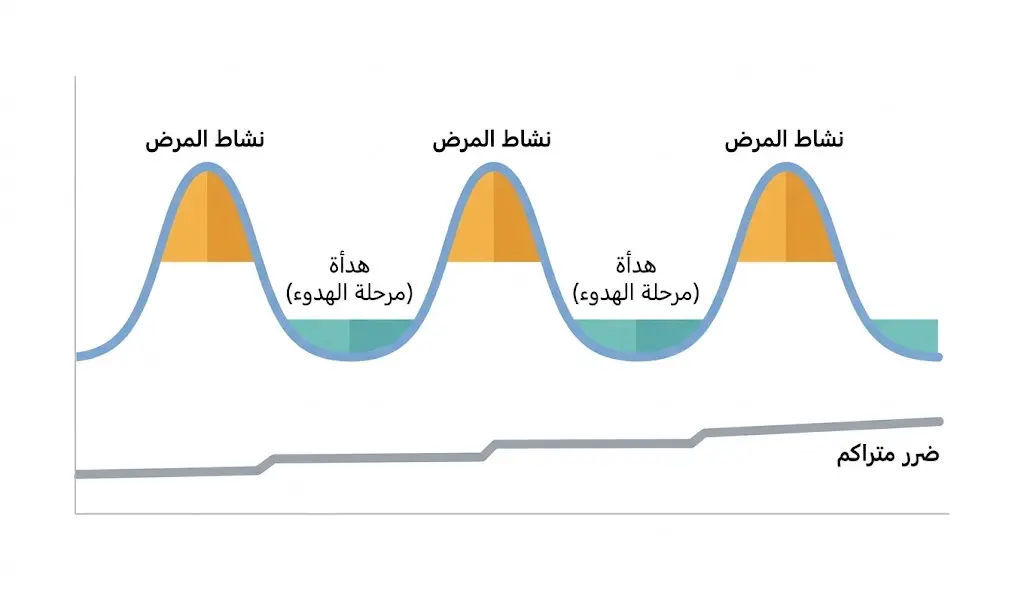 رسم بياني توضيحي يبين الفرق بين نوبات نشاط الذئبة المتقلبة والضرر التراكمي الثابت