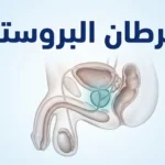 تصميم غلاف يوضح تشريح البروستاتا والمثانة والمستقيم في الحوض الذكري مع عنوان سرطان البروستاتا