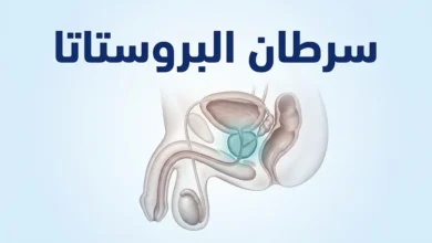 تصميم غلاف يوضح تشريح البروستاتا والمثانة والمستقيم في الحوض الذكري مع عنوان سرطان البروستاتا