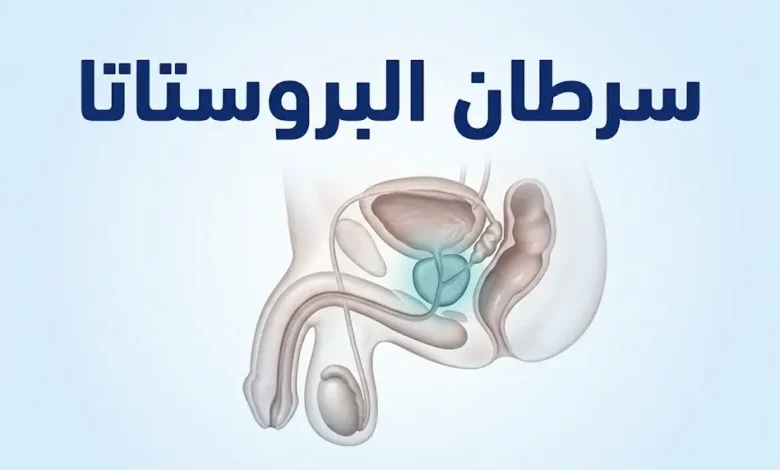 تصميم غلاف يوضح تشريح البروستاتا والمثانة والمستقيم في الحوض الذكري مع عنوان سرطان البروستاتا