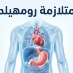 توضيح طبي لمتلازمة رومهيلد يبين العلاقة بين القلب والجهاز الهضمي