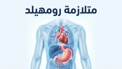 توضيح طبي لمتلازمة رومهيلد يبين العلاقة بين القلب والجهاز الهضمي