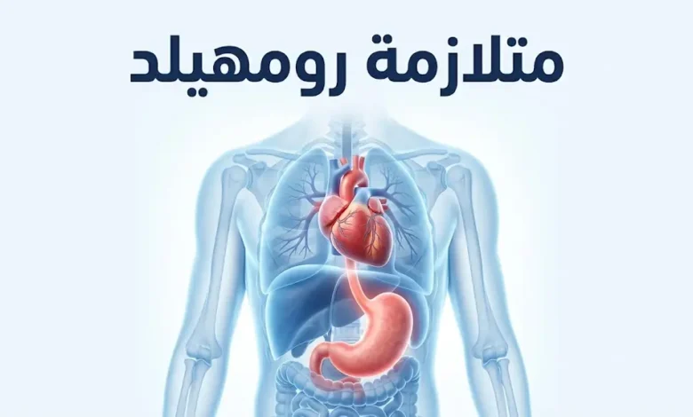 توضيح طبي لمتلازمة رومهيلد يبين العلاقة بين القلب والجهاز الهضمي