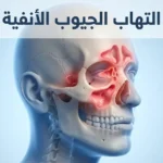 رسم تشريحي ثلاثي الأبعاد يوضح التهاب الجيوب الأنفية داخل الجمجمة