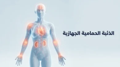 جسم بشري توضيحي يظهر عليه مناطق متعددة من الالتهاب المناعي الذاتي في الذئبة الحمامية الجهازية